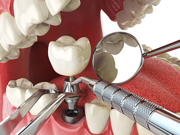 Best Urgent Dental Care in Winchester, IL